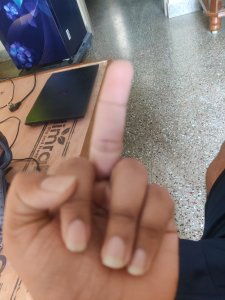 I did ordered a case along with tempered glass they haven't sent the tempered glass and I have raised the concern about this but I haven't received any communication about this